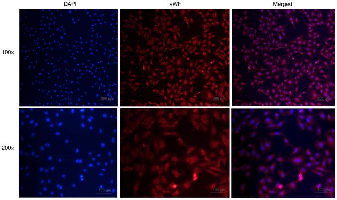 https://cdn.ncbi.nlm.nih.gov/pmc/blobs/b28d/8815058/2375995e4d37/etm-23-03-11152-g01.jpg