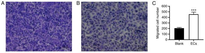 https://cdn.ncbi.nlm.nih.gov/pmc/blobs/b28d/8815058/5031a52dc456/etm-23-03-11152-g02.jpg