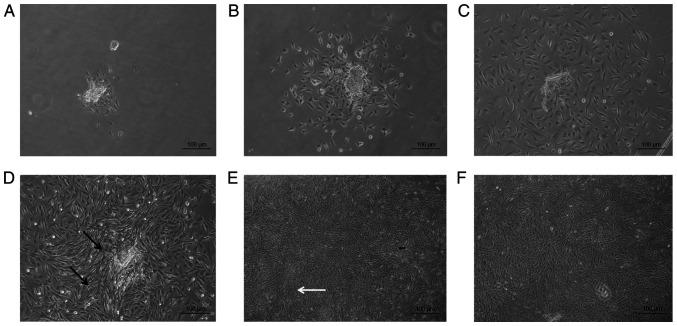 https://cdn.ncbi.nlm.nih.gov/pmc/blobs/b28d/8815058/5abd07343a8f/etm-23-03-11152-g00.jpg