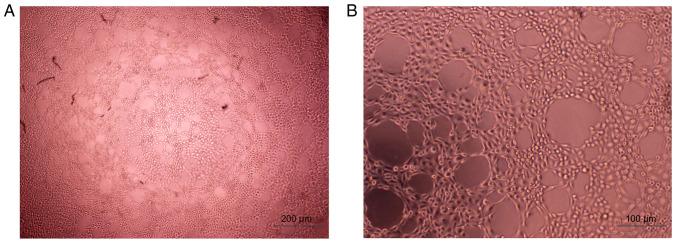 https://cdn.ncbi.nlm.nih.gov/pmc/blobs/b28d/8815058/87e574d7008b/etm-23-03-11152-g03.jpg