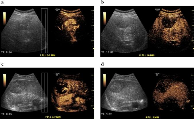 https://cdn.ncbi.nlm.nih.gov/pmc/blobs/b290/8435522/dc1dfe15db86/261_2021_3010_Fig3_HTML.jpg