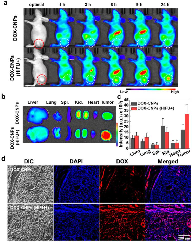 https://cdn.ncbi.nlm.nih.gov/pmc/blobs/b298/11332424/d5c056c5e8d4/IJN-19-8373-g0003.jpg