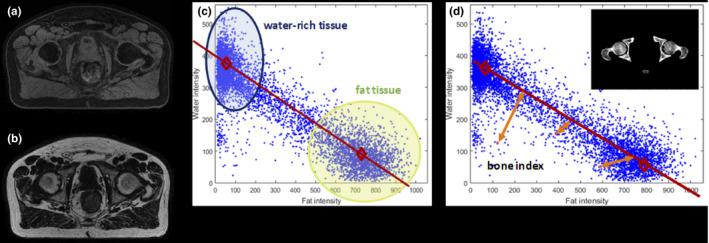 https://cdn.ncbi.nlm.nih.gov/pmc/blobs/b29f/7984497/3877253a306b/ACM2-22-207-g004.jpg