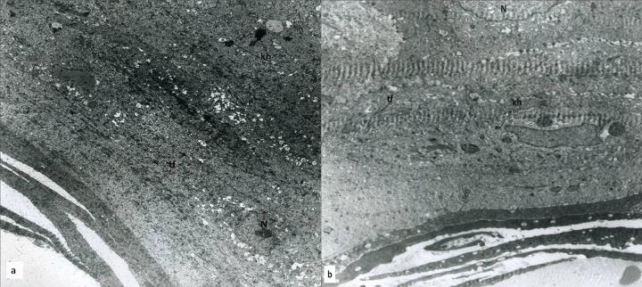 https://cdn.ncbi.nlm.nih.gov/pmc/blobs/b2ac/3983098/4579b1f3458b/medscimonitbasicres-20-36-g005.jpg