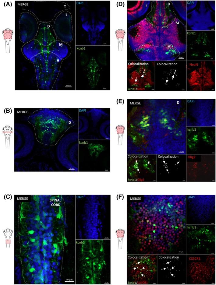 https://cdn.ncbi.nlm.nih.gov/pmc/blobs/b2b1/12371631/3b02ee70c342/EPI-66-3048-g003.jpg