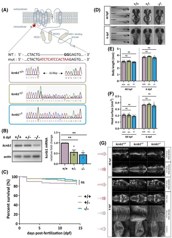 https://cdn.ncbi.nlm.nih.gov/pmc/blobs/b2b1/12371631/f0dc4df11776/EPI-66-3048-g002.jpg
