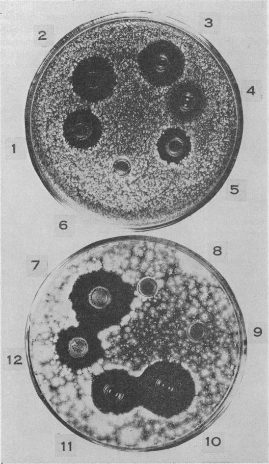 https://cdn.ncbi.nlm.nih.gov/pmc/blobs/b2b4/1078706/1a06bca8724f/pnas01666-0038-a.jpg
