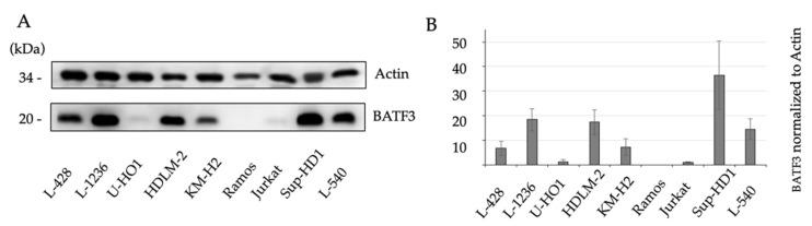 https://cdn.ncbi.nlm.nih.gov/pmc/blobs/b2bc/8234195/dcf0d1276a31/diagnostics-11-01123-g003.jpg