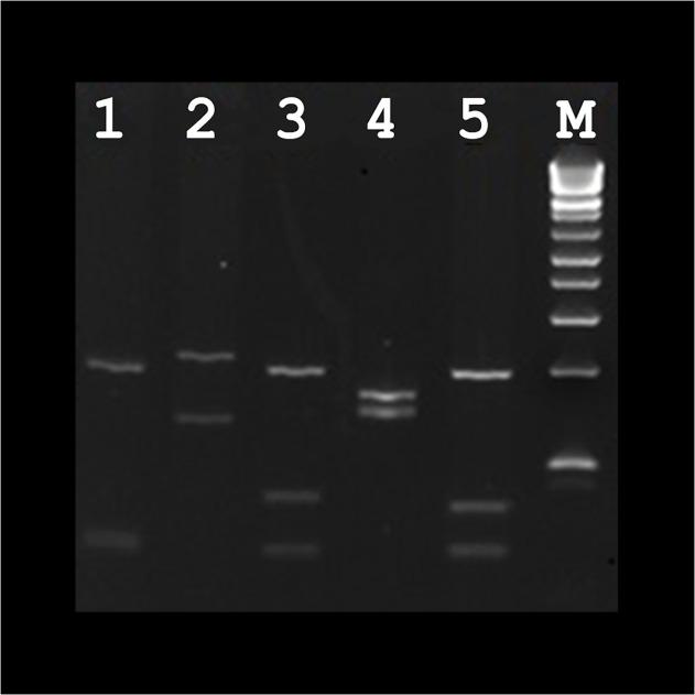 https://cdn.ncbi.nlm.nih.gov/pmc/blobs/b2bd/4348169/bcf34bbee22d/pone.0119212.g001.jpg