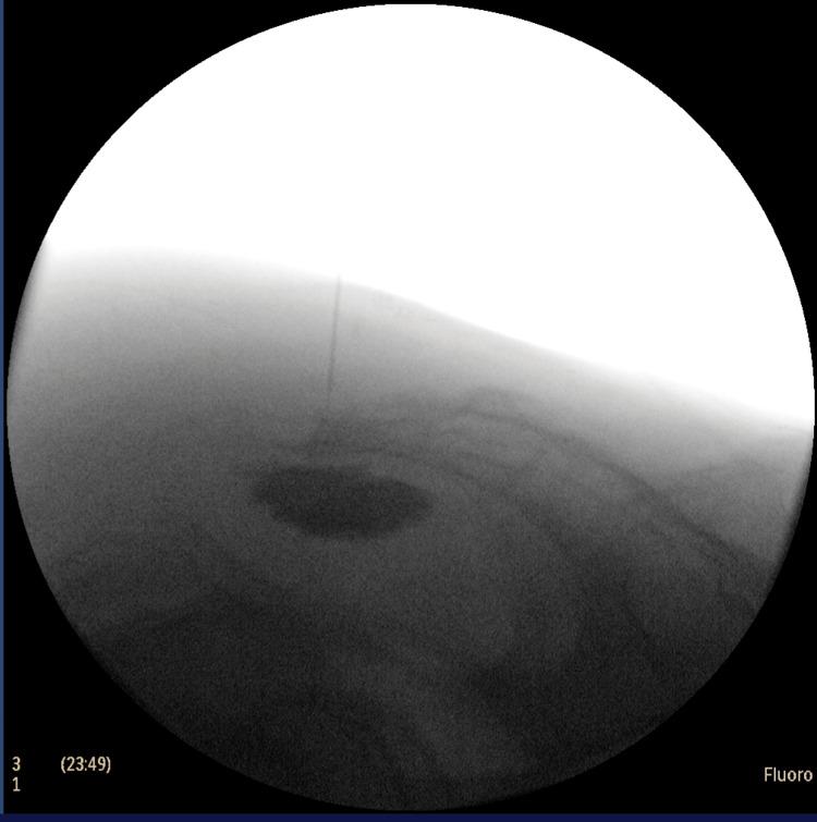 https://cdn.ncbi.nlm.nih.gov/pmc/blobs/b2c3/12422159/545db5169815/cureus-0017-00000089810-i02.jpg