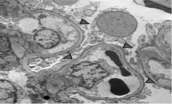 https://cdn.ncbi.nlm.nih.gov/pmc/blobs/b2c5/12271715/9daf2e5f61b2/CRIN2025-5532944.002.jpg