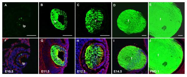 https://cdn.ncbi.nlm.nih.gov/pmc/blobs/b2d1/2567317/60baf2091210/1471-213X-8-88-4.jpg