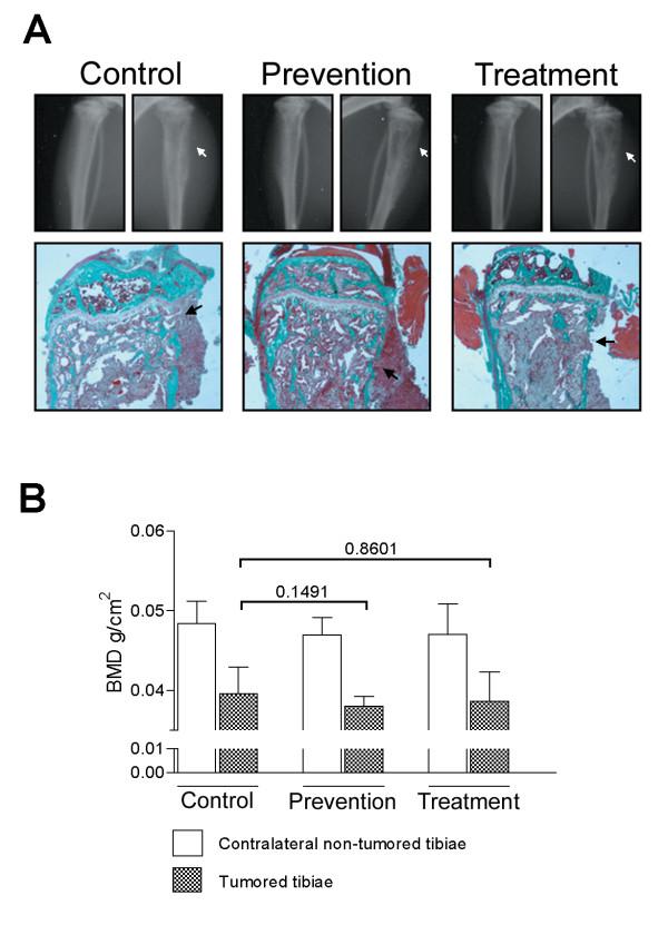 https://cdn.ncbi.nlm.nih.gov/pmc/blobs/b2d8/2034387/60673b077be8/1471-2407-7-148-3.jpg