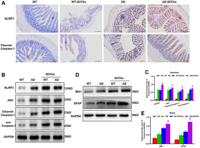 https://cdn.ncbi.nlm.nih.gov/pmc/blobs/b2e0/8457588/f998f0a2506b/aging-13-203487-g002.jpg