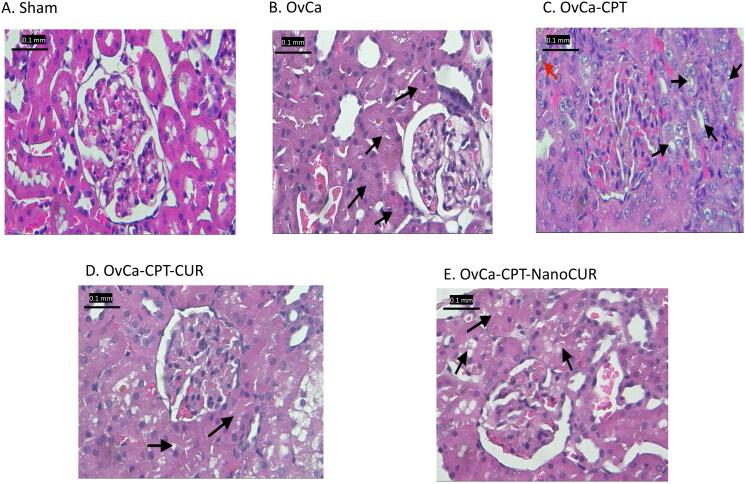 https://cdn.ncbi.nlm.nih.gov/pmc/blobs/b2e7/9888479/506f87048bc7/IPHB_A_2166965_F0003_C.jpg