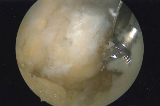 https://cdn.ncbi.nlm.nih.gov/pmc/blobs/b2e8/9134260/8417b3609bda/gr8.jpg