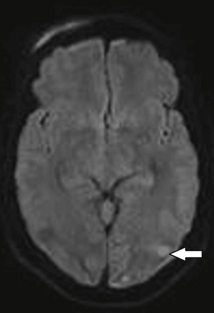 https://cdn.ncbi.nlm.nih.gov/pmc/blobs/b2ea/11694496/25b828660d00/cureus-0016-00000075028-i02.jpg
