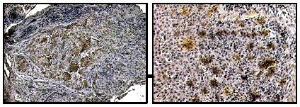 https://cdn.ncbi.nlm.nih.gov/pmc/blobs/b2ea/5725019/b850174c96fb/oncotarget-08-100280-g001.jpg