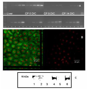 https://cdn.ncbi.nlm.nih.gov/pmc/blobs/b2f5/1774582/502fc79f21a4/1743-8454-3-13-2.jpg