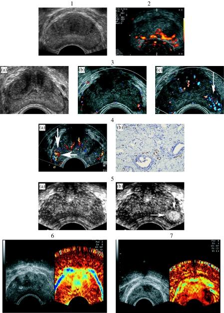 https://cdn.ncbi.nlm.nih.gov/pmc/blobs/b2fe/1665315/15d24173c490/ci05007601.jpg