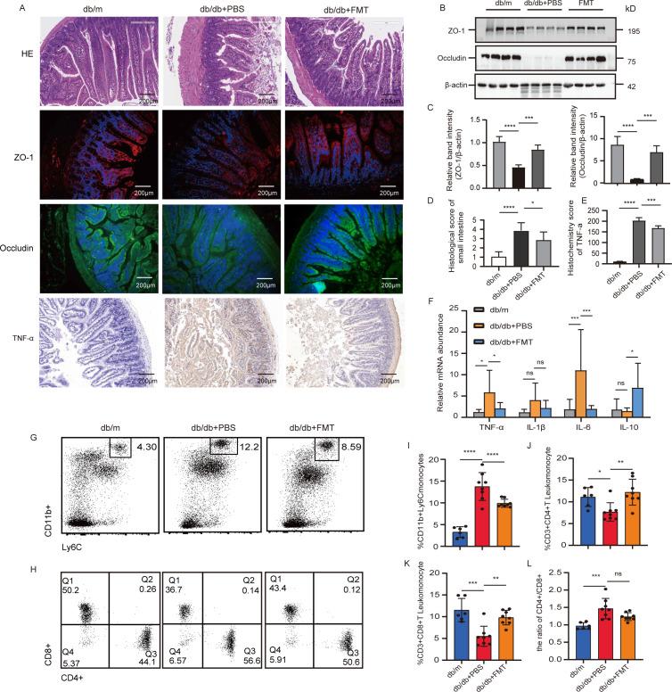 https://cdn.ncbi.nlm.nih.gov/pmc/blobs/b305/10230930/0a22e1849349/bmjdrc-2022-003282f04.jpg