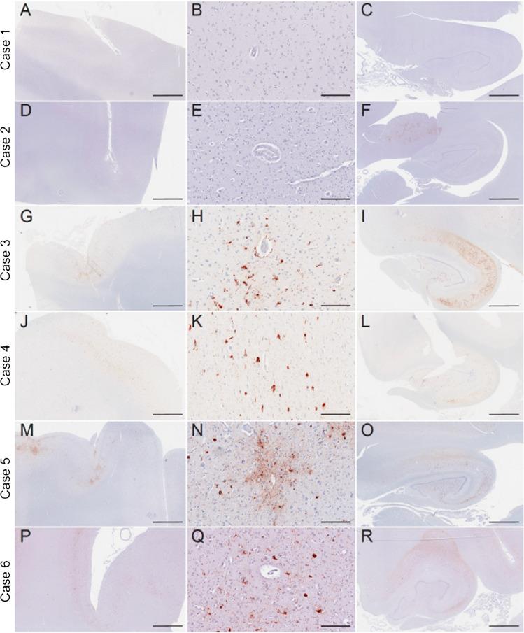 https://cdn.ncbi.nlm.nih.gov/pmc/blobs/b30e/9816291/a0e55ce99309/259_2022_5963_Fig1_HTML.jpg