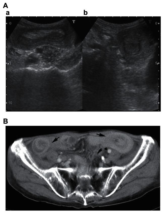 https://cdn.ncbi.nlm.nih.gov/pmc/blobs/b310/3658228/b8499ae0ba74/imcrj-4-001f1.jpg