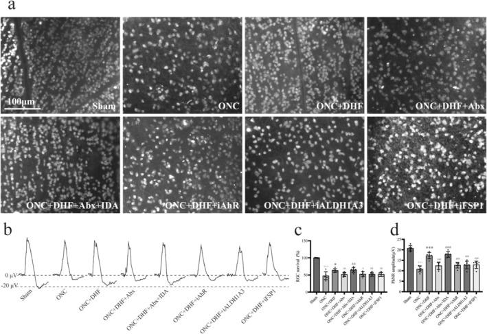 https://cdn.ncbi.nlm.nih.gov/pmc/blobs/b316/12076127/888eca4d4a49/CNS-31-e70442-g008.jpg