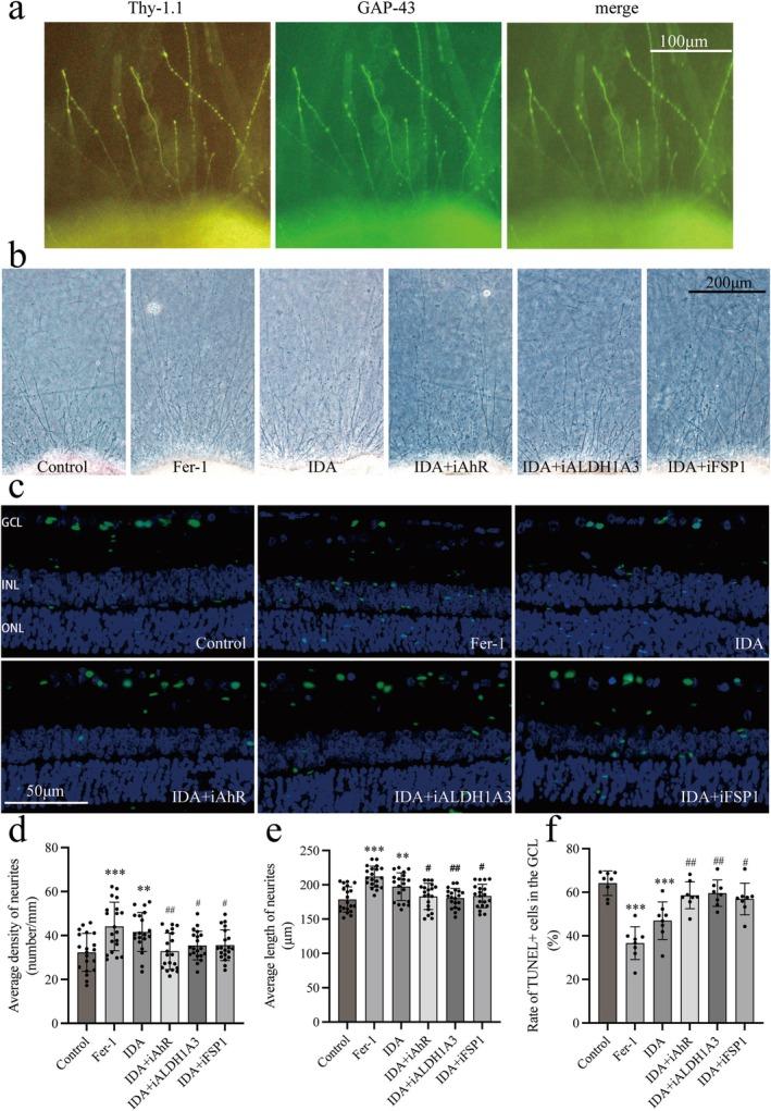 https://cdn.ncbi.nlm.nih.gov/pmc/blobs/b316/12076127/c2a171bcbf6f/CNS-31-e70442-g009.jpg
