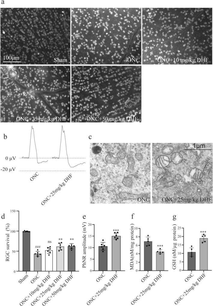 https://cdn.ncbi.nlm.nih.gov/pmc/blobs/b316/12076127/cf6c99c4a4f3/CNS-31-e70442-g006.jpg
