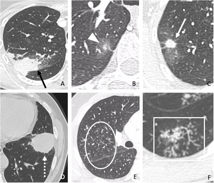 https://cdn.ncbi.nlm.nih.gov/pmc/blobs/b318/7820493/7847dde22d9a/gr2.jpg