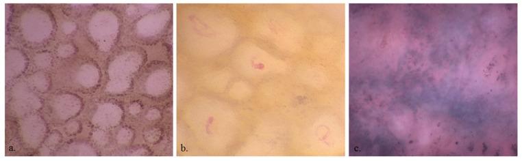 https://cdn.ncbi.nlm.nih.gov/pmc/blobs/b31a/10340569/bbc47641eaf5/diagnostics-13-02238-g003.jpg