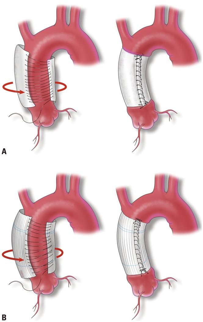https://cdn.ncbi.nlm.nih.gov/pmc/blobs/b31a/6938774/f1059f9f699f/ymj-61-40-g001.jpg