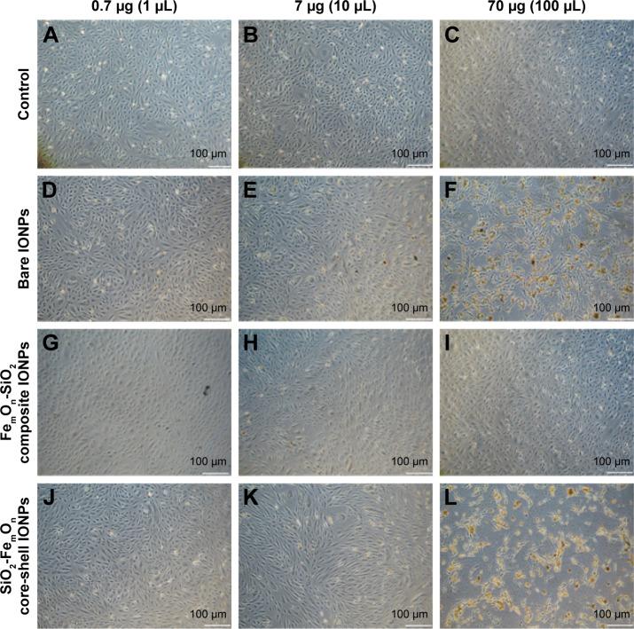 https://cdn.ncbi.nlm.nih.gov/pmc/blobs/b31d/5245979/d623a65dbe9a/ijn-12-593Fig3.jpg