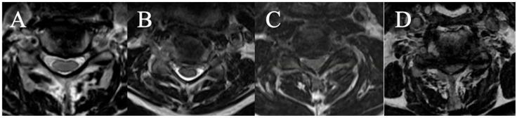 https://cdn.ncbi.nlm.nih.gov/pmc/blobs/b31e/12190962/5436991f86b7/brainsci-15-00557-g003.jpg