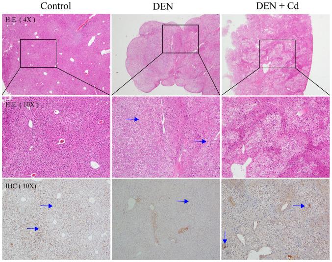https://cdn.ncbi.nlm.nih.gov/pmc/blobs/b321/8669683/9fea1af3a34f/ol-23-01-13151-g04.jpg