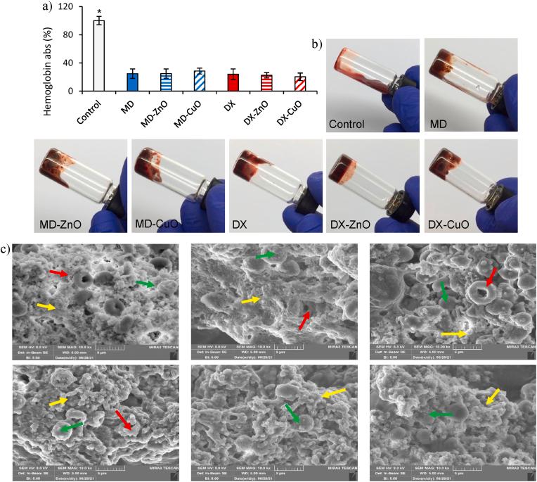 https://cdn.ncbi.nlm.nih.gov/pmc/blobs/b323/9489812/f01d50c4c532/gr7.jpg