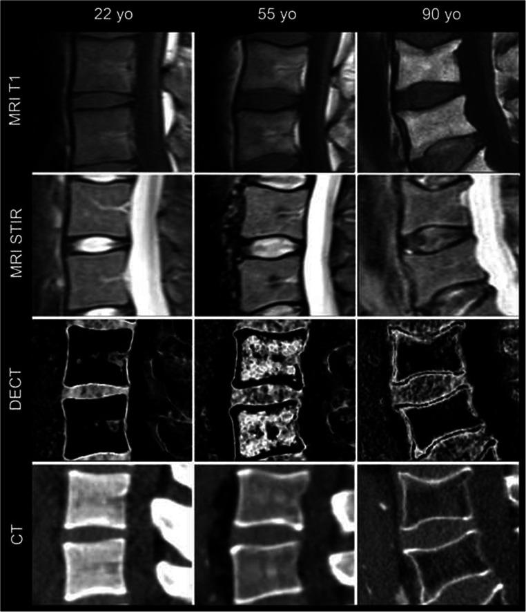 https://cdn.ncbi.nlm.nih.gov/pmc/blobs/b342/8589800/25cb96887c26/330_2021_8028_Fig3_HTML.jpg