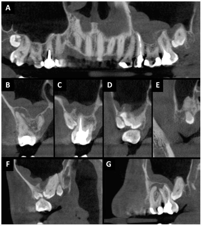 https://cdn.ncbi.nlm.nih.gov/pmc/blobs/b346/11049874/1760f31c2e8a/ijms-25-04339-g001.jpg