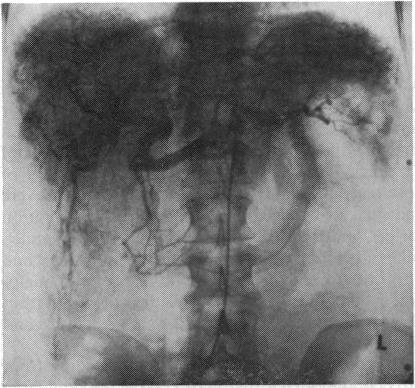 https://cdn.ncbi.nlm.nih.gov/pmc/blobs/b34d/1412032/d93434fbcfee/gut00463-0088-a.jpg