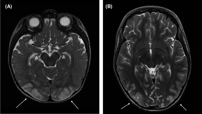 https://cdn.ncbi.nlm.nih.gov/pmc/blobs/b34e/7813126/0b6b64e9d628/CCR3-9-260-g002.jpg