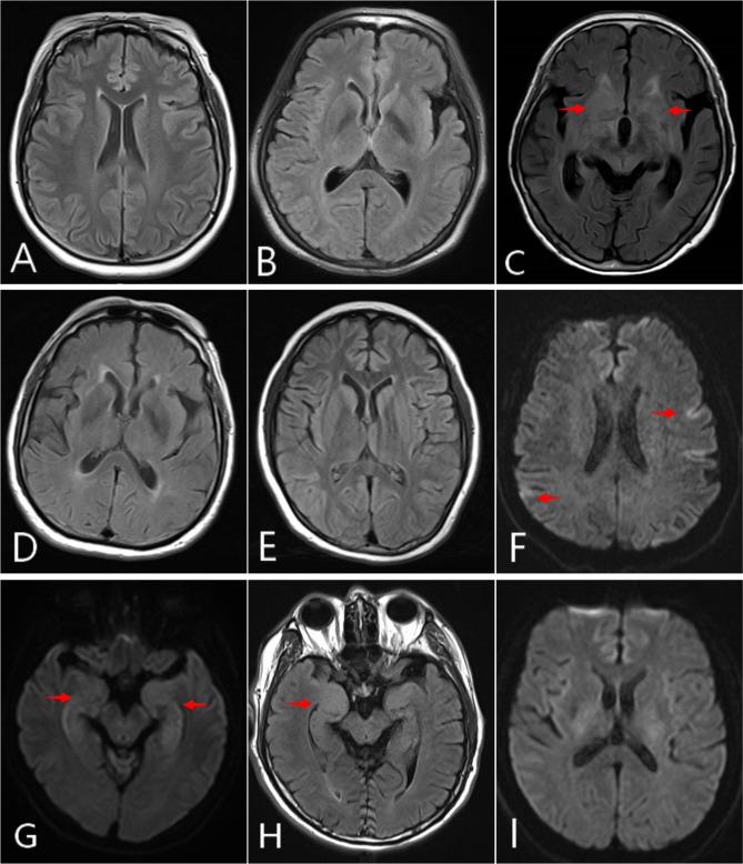 https://cdn.ncbi.nlm.nih.gov/pmc/blobs/b352/10759401/7d5674071bd1/12883_2023_3514_Fig1_HTML.jpg