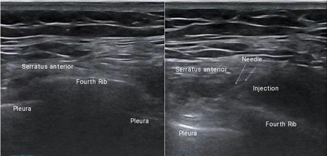 https://cdn.ncbi.nlm.nih.gov/pmc/blobs/b355/12065182/fd85f8bb1c8f/12871_2025_3101_Fig1_HTML.jpg