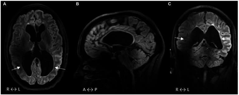 https://cdn.ncbi.nlm.nih.gov/pmc/blobs/b358/10112510/6dc06a7e2fdb/fnins-17-1143044-g002.jpg
