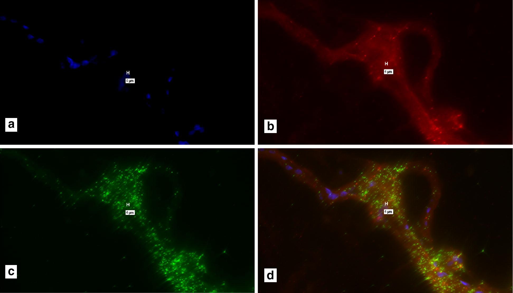 https://cdn.ncbi.nlm.nih.gov/pmc/blobs/b35b/6054717/5ef892173701/13104_2018_3601_Fig1_HTML.jpg
