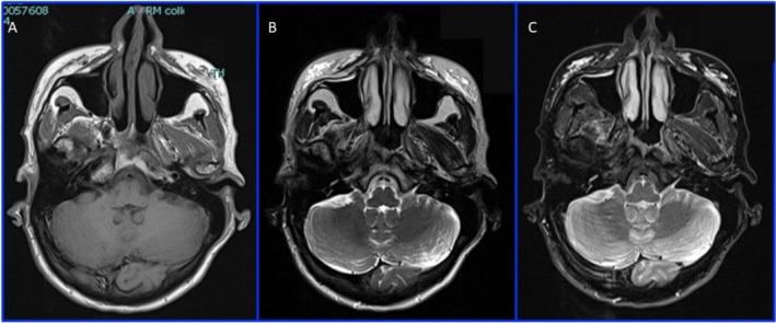 https://cdn.ncbi.nlm.nih.gov/pmc/blobs/b35d/11978728/562abd689689/CCR3-13-e70402-g004.jpg