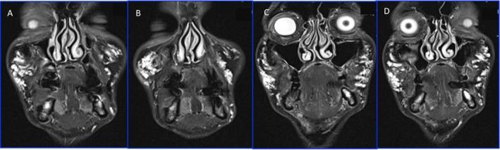 https://cdn.ncbi.nlm.nih.gov/pmc/blobs/b35d/11978728/bd1c75ecfa80/CCR3-13-e70402-g006.jpg