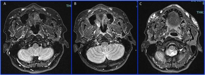 https://cdn.ncbi.nlm.nih.gov/pmc/blobs/b35d/11978728/c3e32ca56e6b/CCR3-13-e70402-g001.jpg