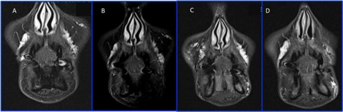 https://cdn.ncbi.nlm.nih.gov/pmc/blobs/b35d/11978728/d12f82d94ae3/CCR3-13-e70402-g005.jpg