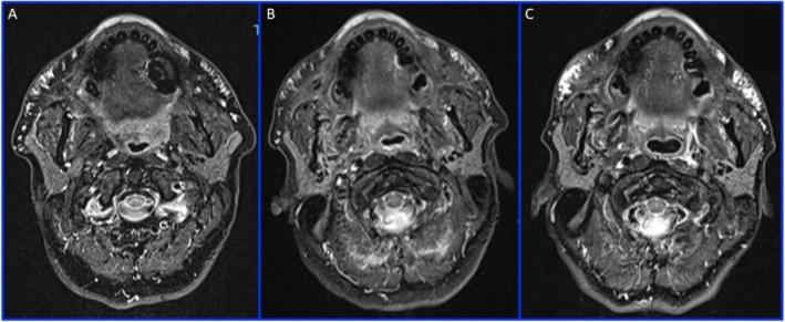 https://cdn.ncbi.nlm.nih.gov/pmc/blobs/b35d/11978728/f7b917d9b517/CCR3-13-e70402-g002.jpg